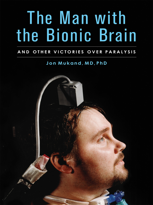 Cover image for The Man with the Bionic Brain